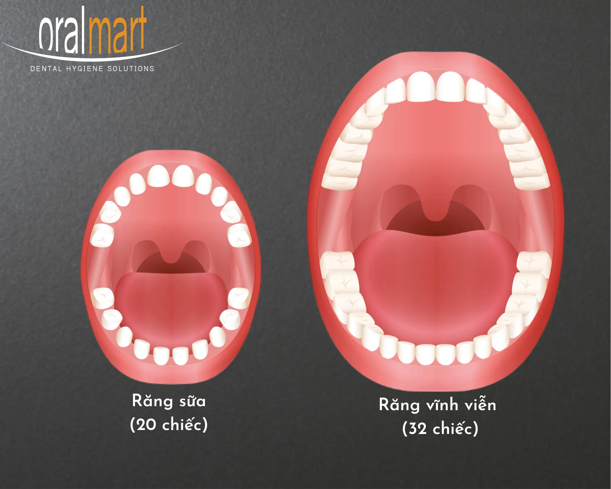 Cách phân biệt răng sữa và răng vĩnh viễn