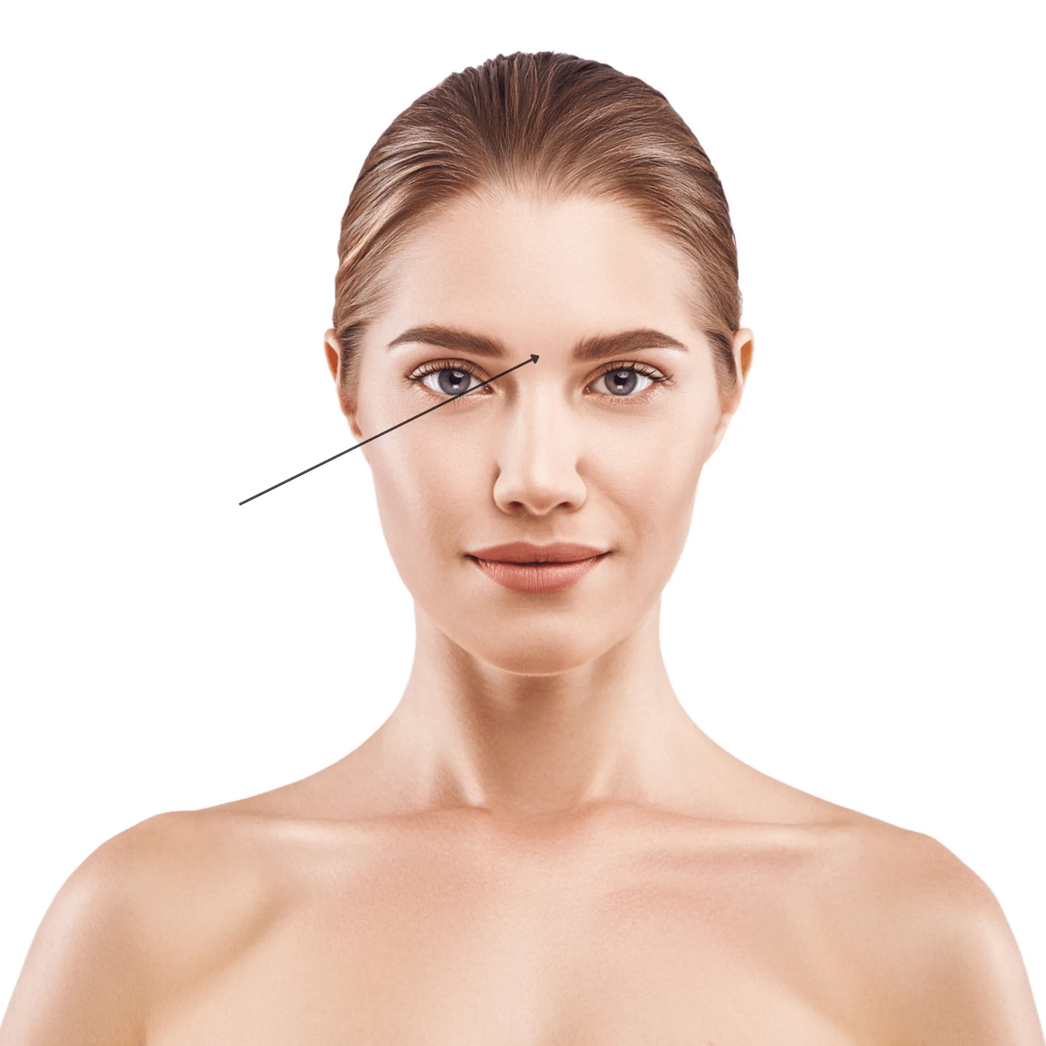 Niềng răng đúng sẽ làm điểm Glabella và đường trục khuôn mặt phải thẳng, trùng với đường nhân trung, đỉnh mũi, 2 hàm 