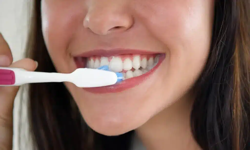 Đánh răng ít nhất 2 lần mỗi ngày ngừa sâu răng cửa