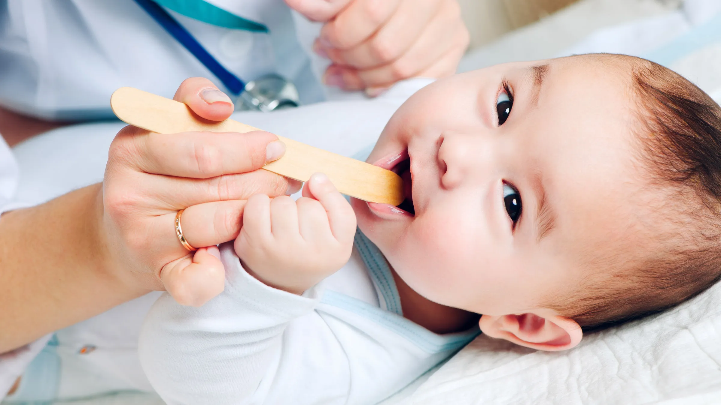 Chăm sóc điều trị nấm miệng cho trẻ sơ sinh 