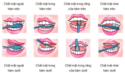 Hướng dẫn cách chăm sóc răng miệng khi bị sâu răng