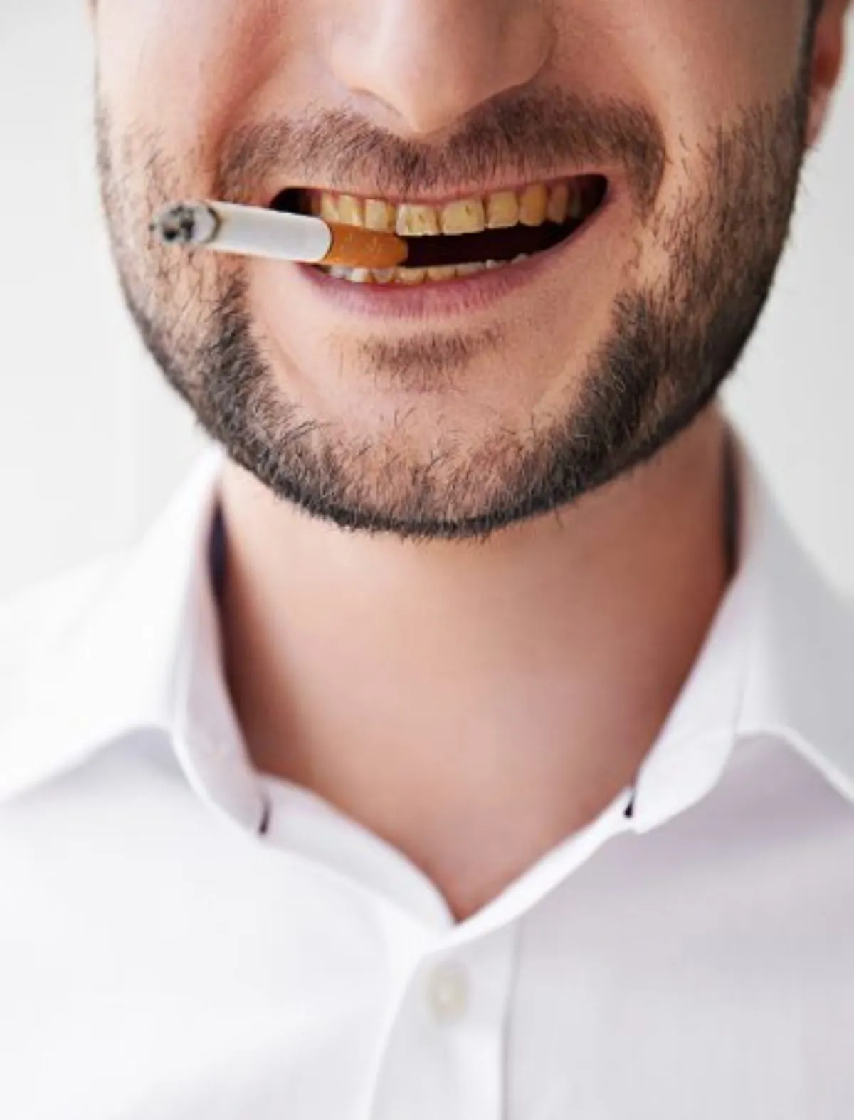 Hút thuốc lá tăng nguy cơ tạo vệt ố vàng trên răng