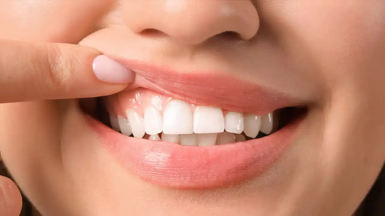 Kem đánh răng cho răng nhạy cảm giúp bảo vệ nướu răng