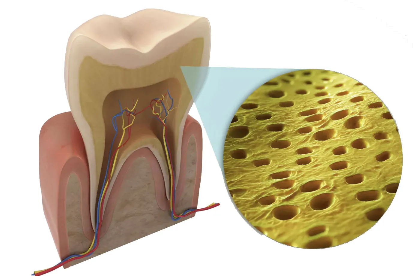 Hydroxyapatite giúp bịt kín ống ngà răng, ngăn chặn cơn ê buốt