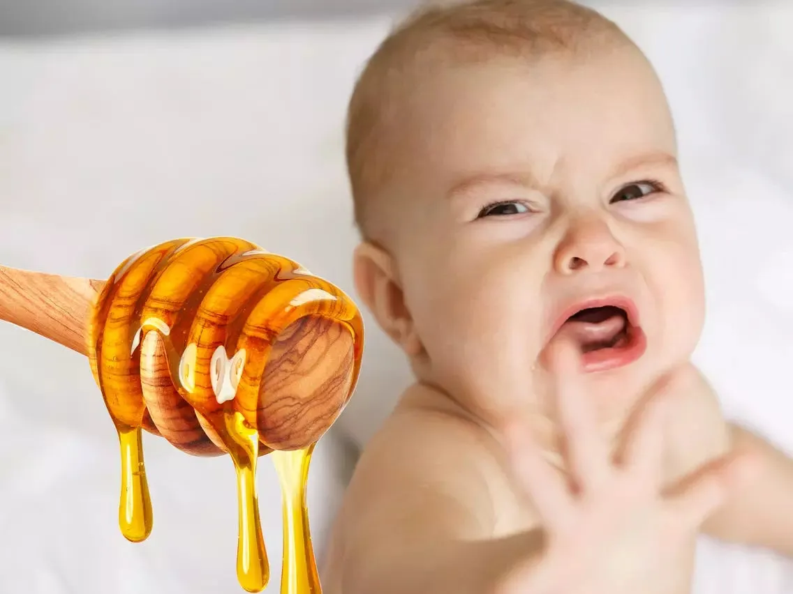 Không nên sử dụng mật ong cho trẻ sơ sinh bị loét miệng