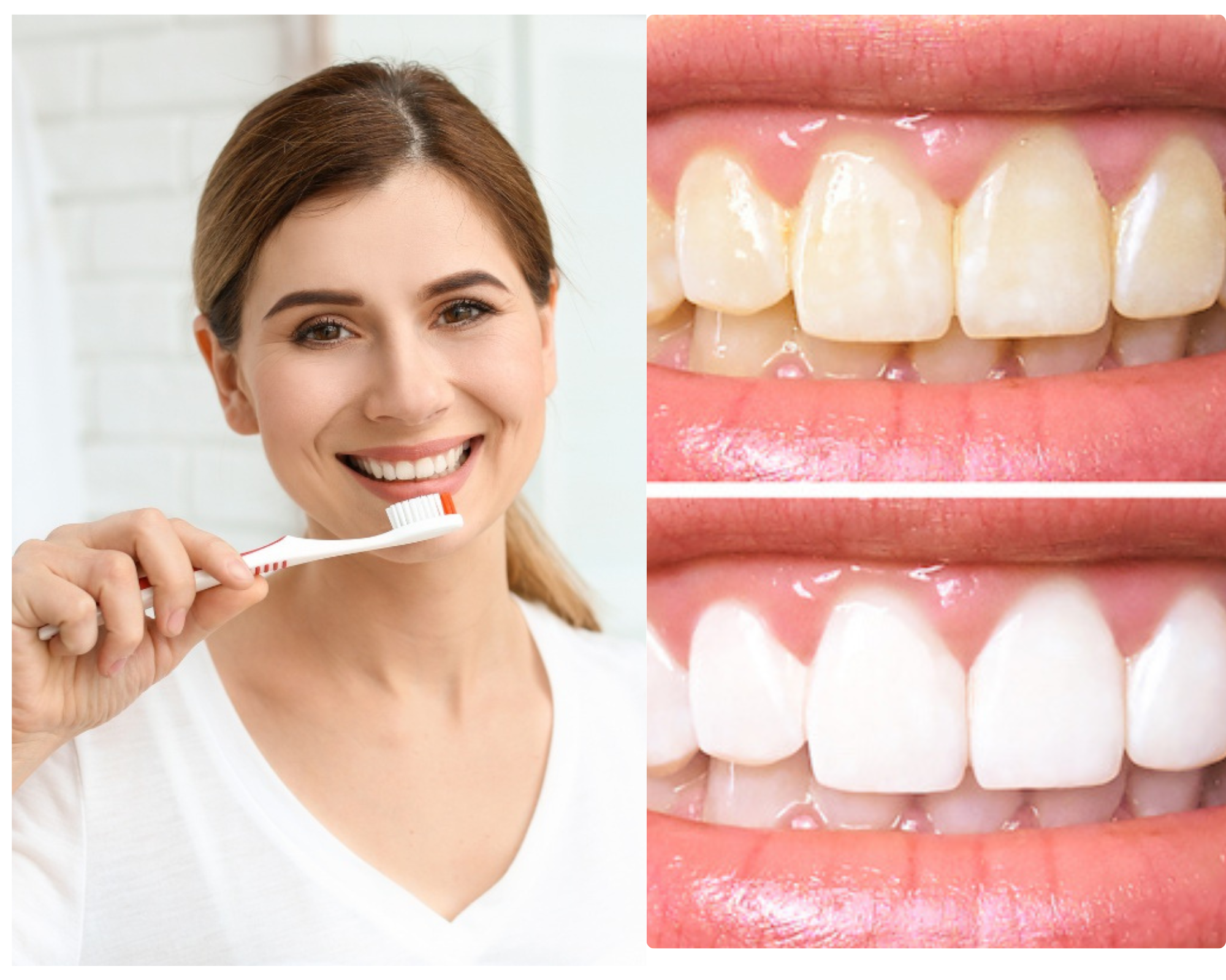 Sử dụng kem đánh răng trắng răng để tăng hiệu quả làm trắng