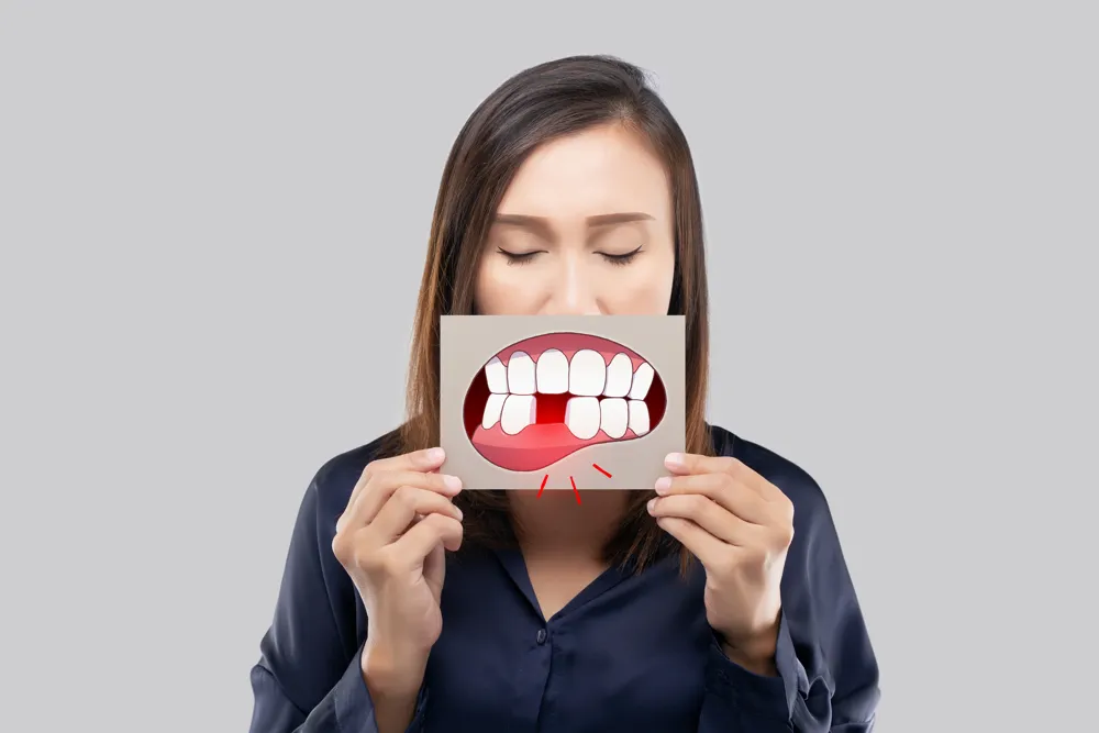 Mất răng ảnh hưởng đến tâm lý