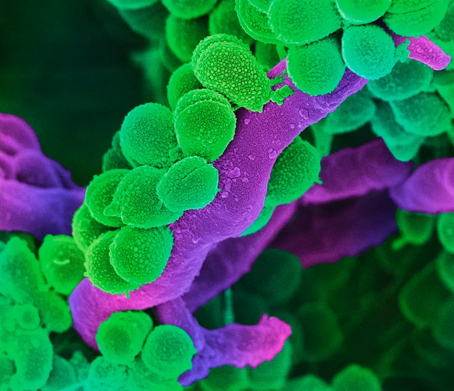 Vi khuẩn Streptococcus trong khoang miệng