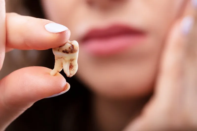 Răng thật có thể chết tủy sau khi bọc răng sứ