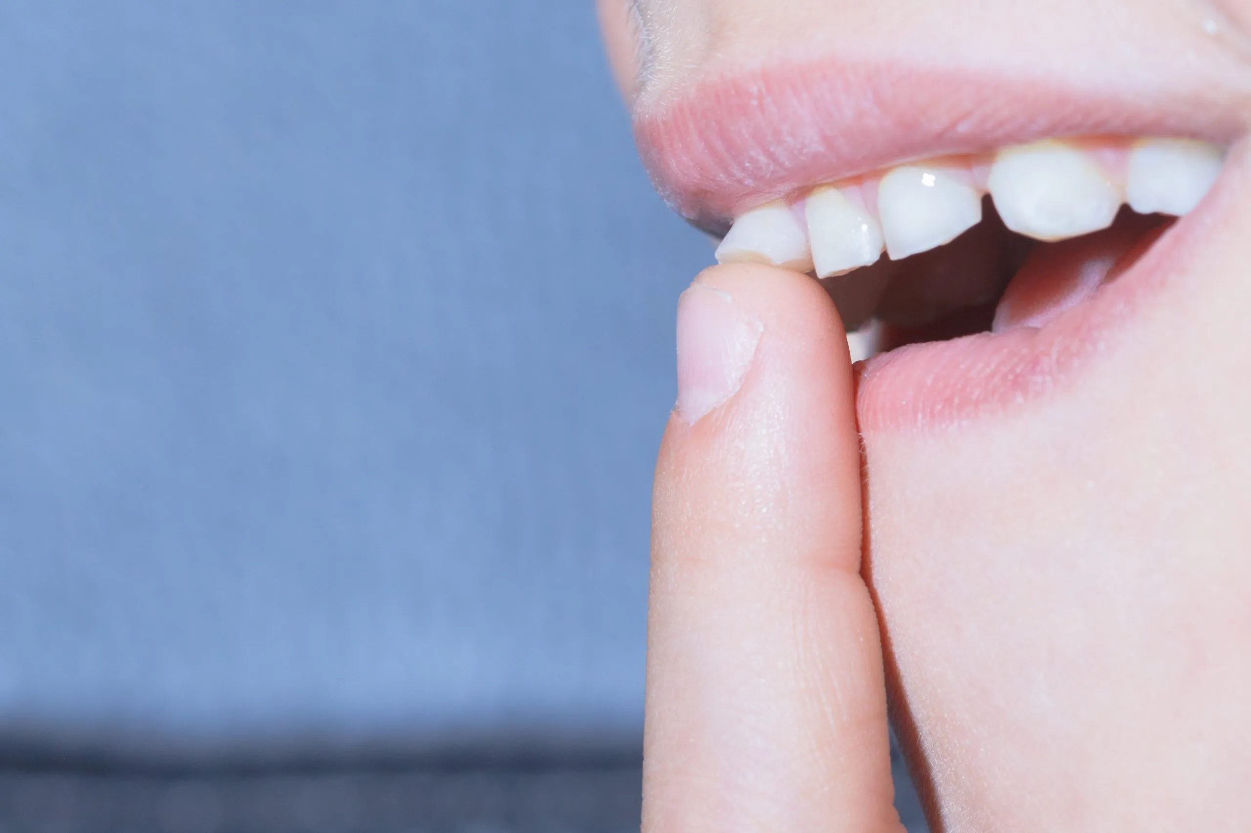 Răng sâu bị yếu và dễ lung lay