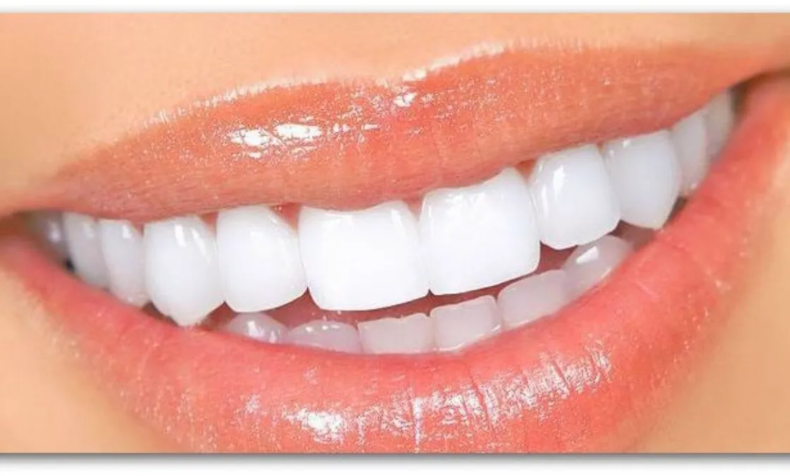 Màu răng trắng sáng tự nhiên, có độ bóng khỏe