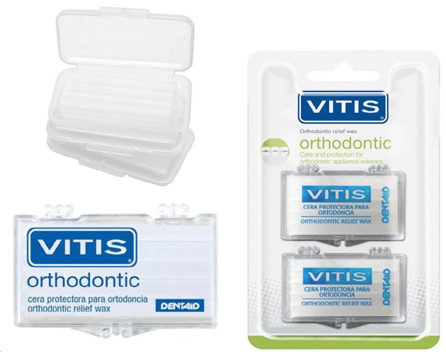 Sử dụng sáp chỉnh nha VITIS Orthodontic để bảo vệ thành lợi và môi trong quá trình niềng răng