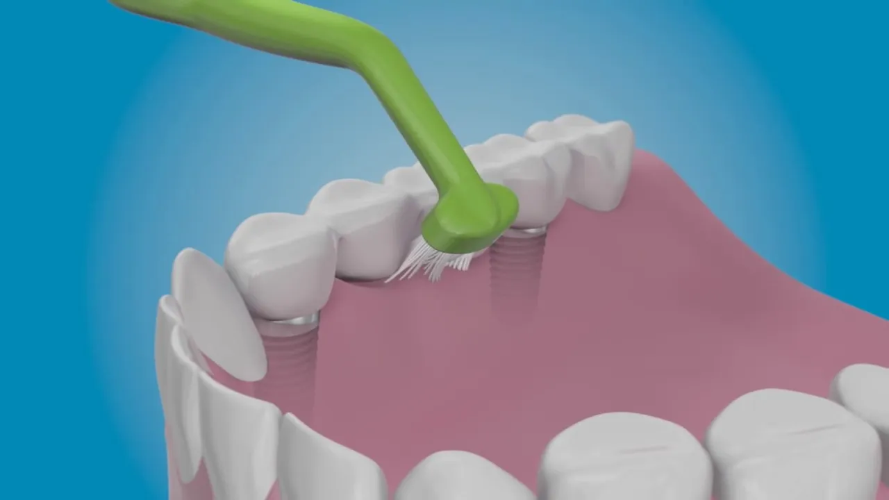 Sử dụng bàn chải chuyên dụng để vệ sinh răng miệng