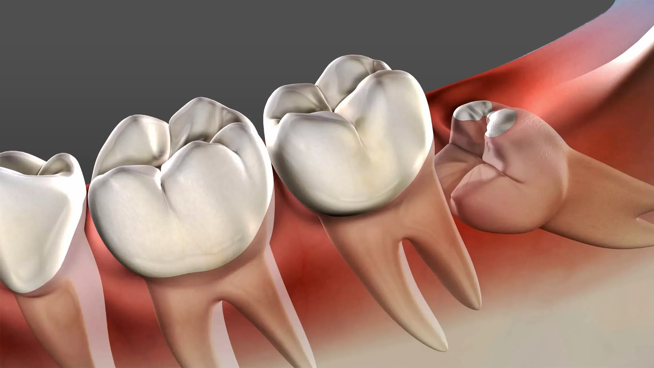 Tình trạng răng quyết định quá trình lành thương sau nhổ răng