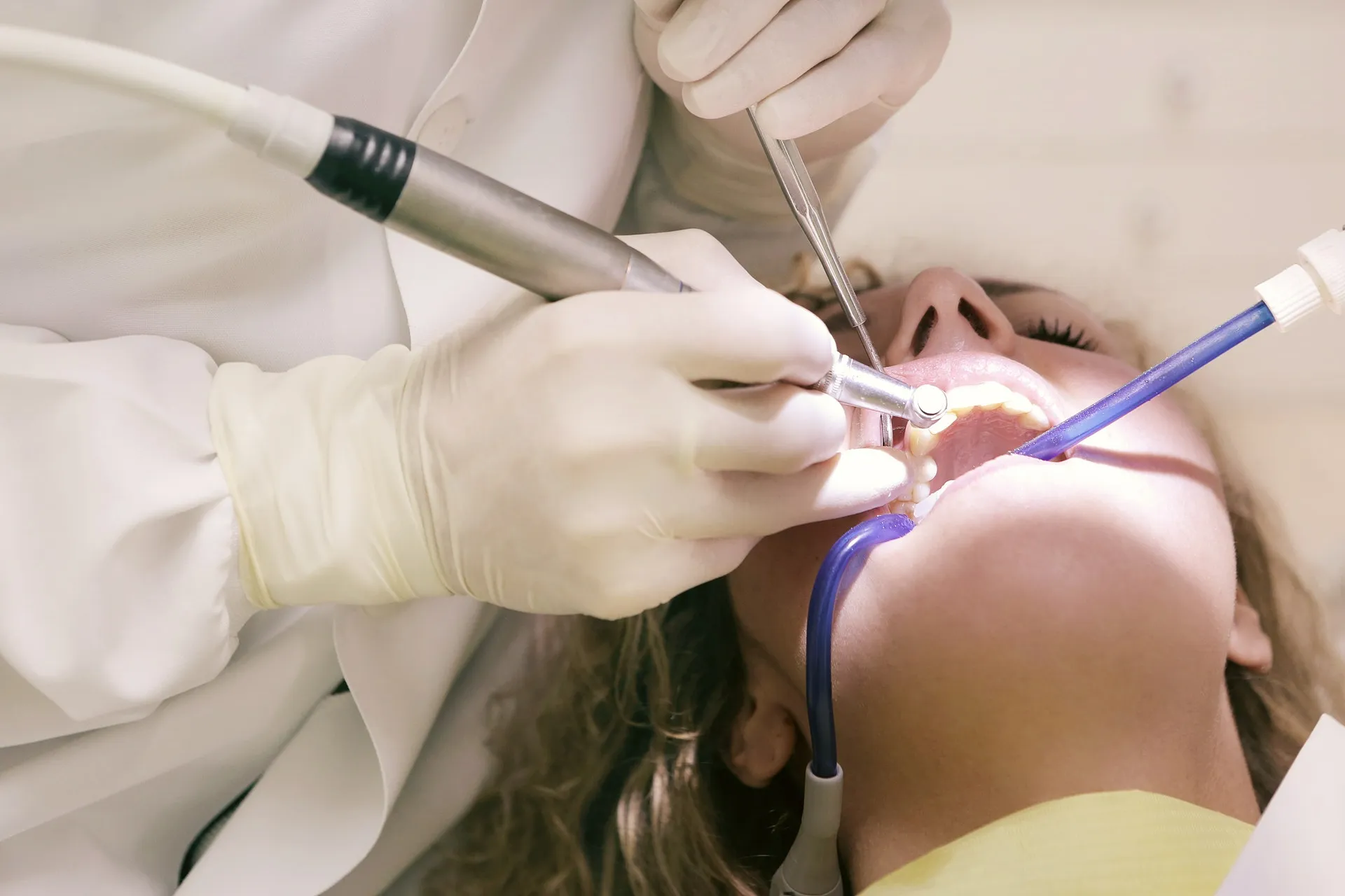Có thể tiến hành trám răng lần hai cho bệnh nhân nếu vết trám bị hở hoặc mòn