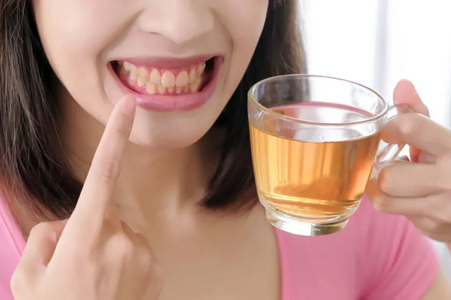 Thường xuyên uống trà có thể khiến răng bị xỉn màu, ố vàng