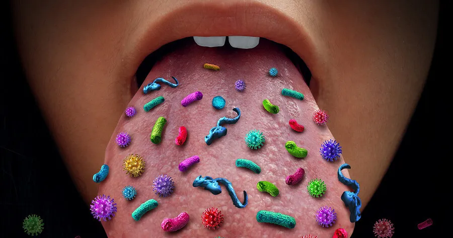 Mảng bám vi khuẩn tích tụ trên lưỡi làm sản sinh các hợp chất lưu huỳnh dễ bay hơi (VSC) gây hôi miệng